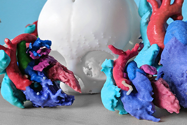 A series of 3DI Lab-3D printed models for cardiac and skeletal diseases. Photo via Rady Children's Hospital. 