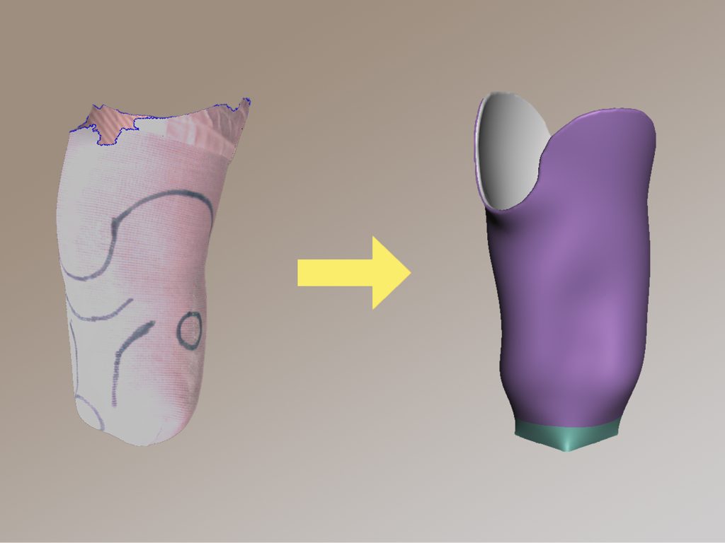 Designing the prosthesis. Photo via 3D Sierra Leone