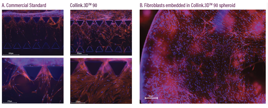 Micrographies fluorescentes de la culture de cellules 3D se déroulant dans l'hydrogel Collink.3D 90.  Image via CollPlant.  
