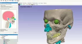 Craniomaxillofacial CT Auto Segmenter tool. Image via Synopsys.