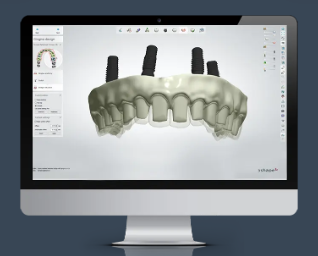 Le logiciel Dental System de 3Shape.  Image via 3Shape.