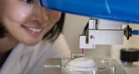 3D bioprinting artificial cartilage. Photo via The Scar Free Foundation
