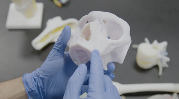 Anatomic 3D-printed models allow medical staff to practice and plan for surgeries. Image via Stratasys.