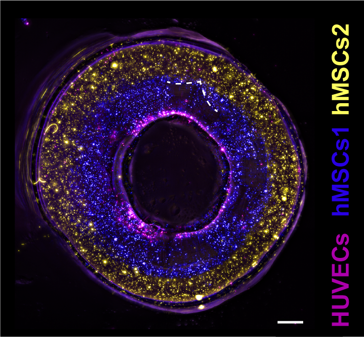 برش عرضی رگ چاپ شده با سلول های اپیتلیال (بنفش) و دو نوع سلول بنیادی (آبی، زرد) برای تقلید از لایه های دیواره رگ خونی.  تصویر از طریق LevatoLab، UMC Utrecht.