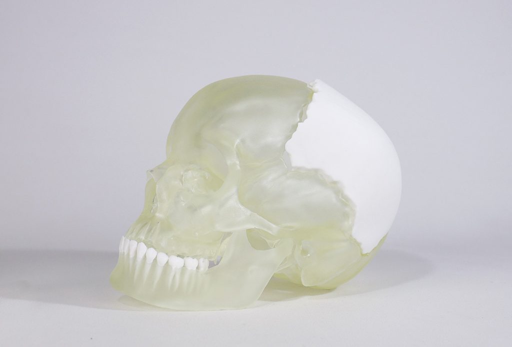Medical model 3D printed with Liqcreate Bio-Med Clear resin. Photo via Liqcreate.