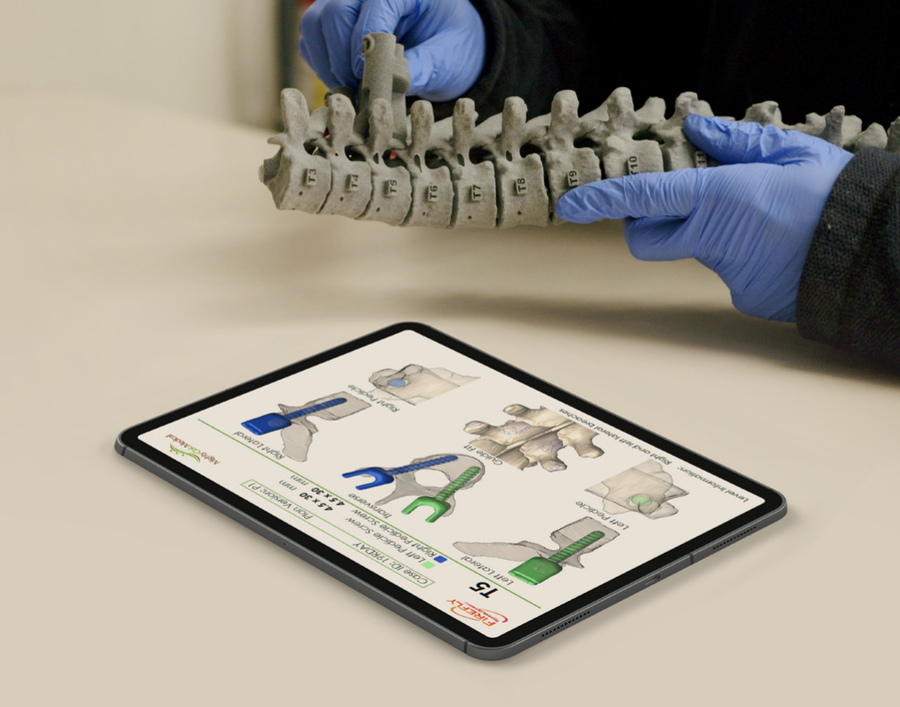 The Firefly solution streamlines the spinal surgery process. Image via Mighty Oak Medical.