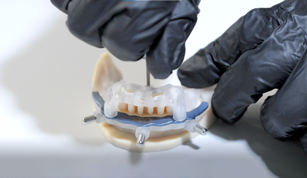 3D printed dental component. Photo via Stratasys.
