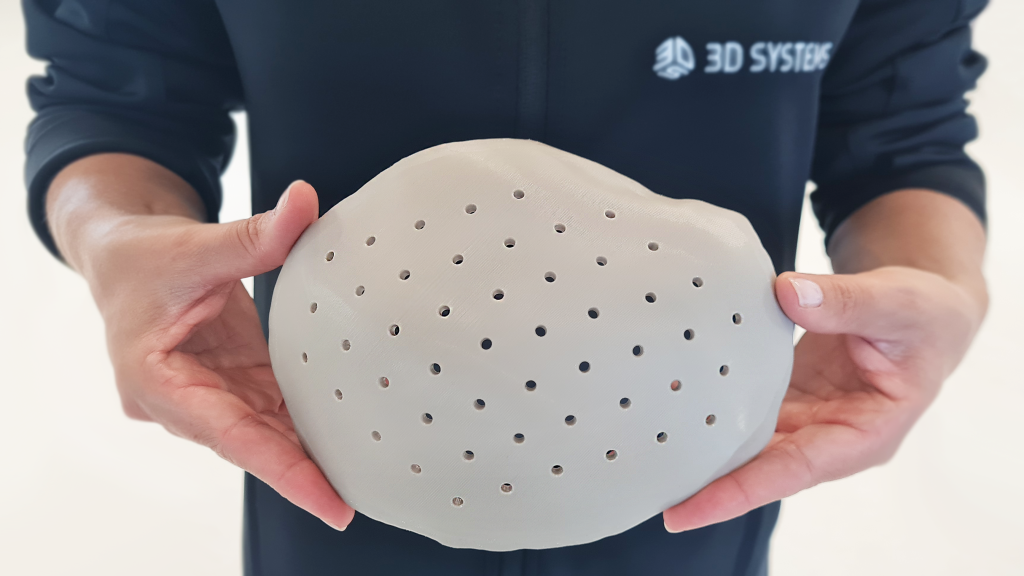3D Systems' creates first cranial implant using its point-of-care 3D printing technologies. Photo via 3D Systems.