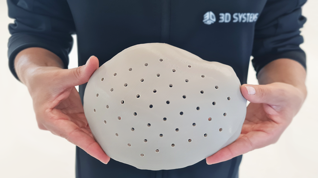 The VSP PEEK Cranial Implant is the first FDA-cleared, additively manufactured PEEK implant intended for cranioplasty procedures to restore defects in the skull. Photo via 3D Systems.