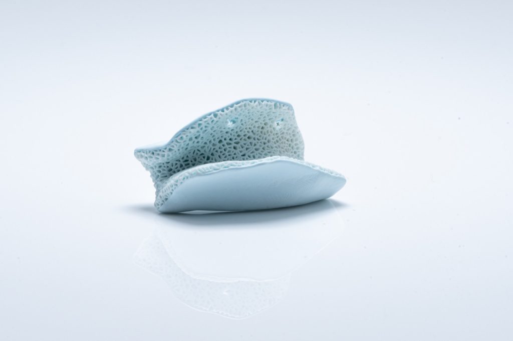 Lithoz’s CeraFab Multi can produce innovative applications for healthcare, such as this multi-material jaw augmentation part made from two different bioresorbable ceramics with various porosities. Image via Lithoz. 