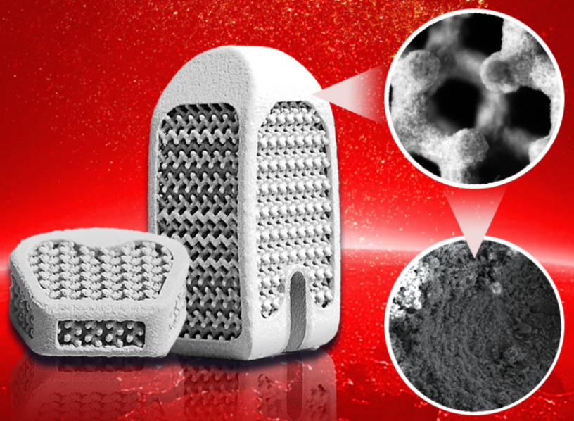 The Hydroxyapatite-Coated Porous Titanium Alloy Interbody Fusion Device developed by Wedo. Image via Bright Laser Technologies.