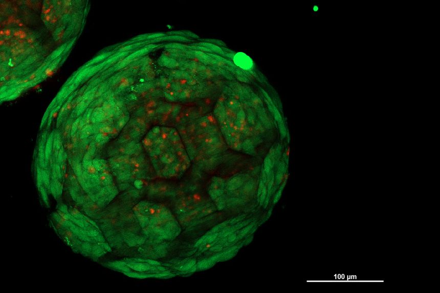 3D printed spheroid, filled with living cells. Image via TU Wien.
