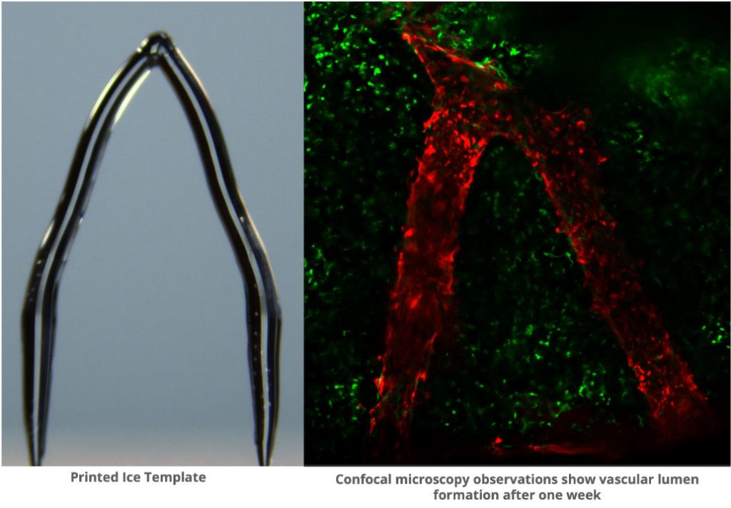 3D printed ice template of blood vessels shown on the left. The right shows imaging of cells forming a blood vessel-like structure on the template one week later. Photo via CMU.