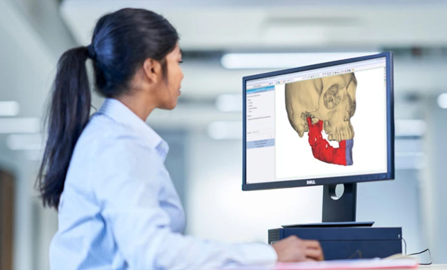 Materialise's new system offer digitalized workflow for TMJ surgery. Photo via Materialise.
