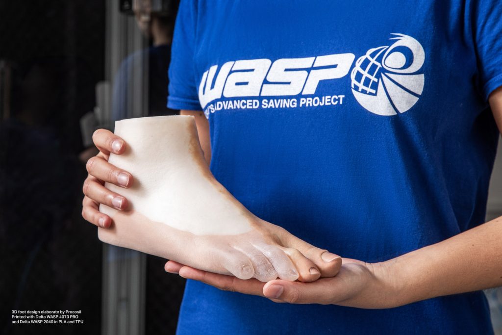 3D printed foot produced by Procosil. Photo via WASP.