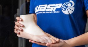 3D printed foot produced by Procosil. Photo via WASP.