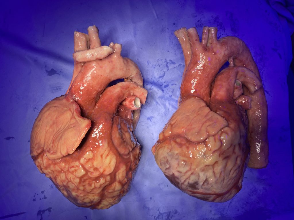 NTU 3D printed heart models. Photo via Nottingham Trent University.