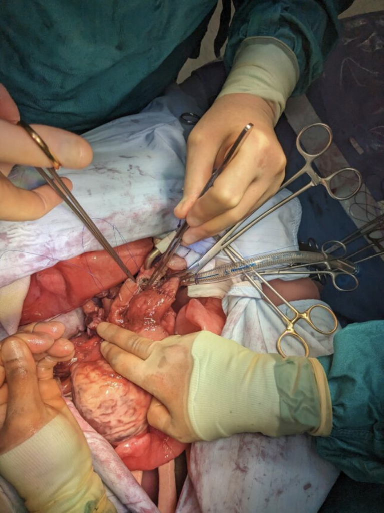 Surgeons practising organ transplant procedures with an NTU 3D printed heart model. Photo via Nottingham Trent University.