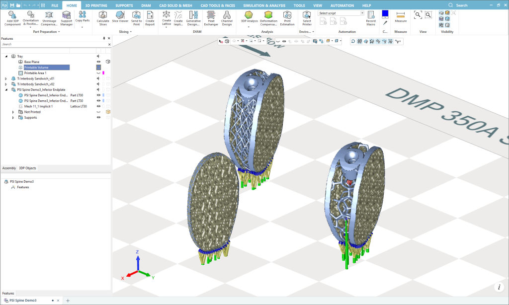 A 3D-printed spinal cage with lattice structures. Image via Oqton