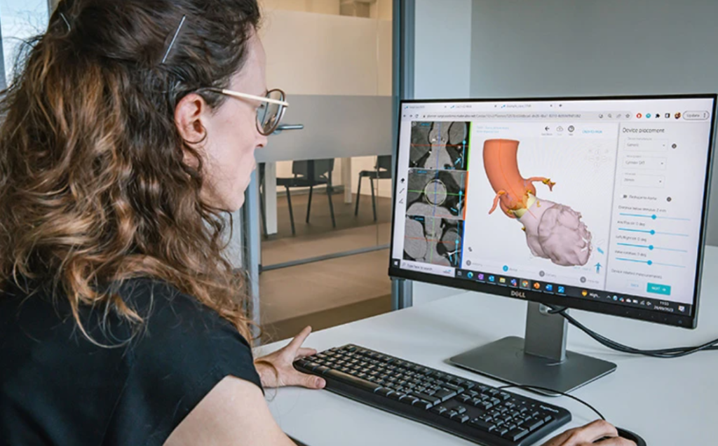 A woman looking at a computer screen showing the anatomical overview of an aortic root on SurgiCase software. Photo via Materialise.