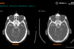 Stratasys and Siemens Develop 3D Printed Phantoms for Medical Imaging