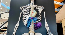 3D printed anatomical models at Materialise HQ in Leuven. Photo by 3D Printing Industry