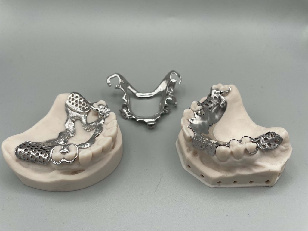 Removable partial dentures 3D printed using TRUMPFās TruPrint 1000 system. Photo via TRUMPF.