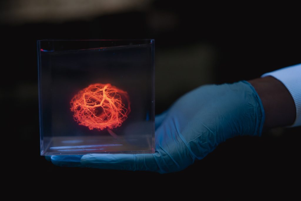 A model of a vascular tree printed using a 3D bioprinter. Image via Andrew Brodhead.