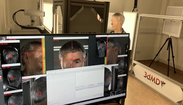 The medical centre can both scan and print prosthesis for patients. Photo via BBC.