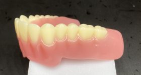 3D Systems jetted denture. Photo via 3D Systems.