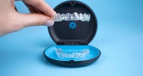 3D printed Invisalign treatment. Image via Align Technology.
