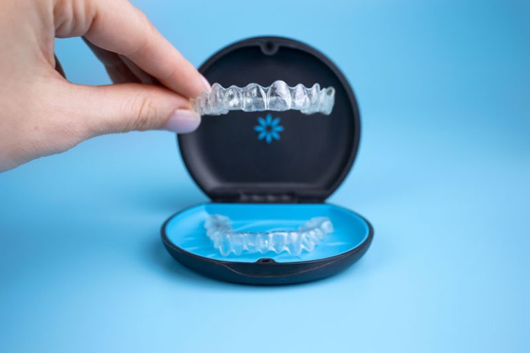 3D printed Invisalign treatment. Image via Align Technology.