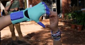 Lois can do anything using her 3D printed hand. Photo via ABC Mid North Coast.