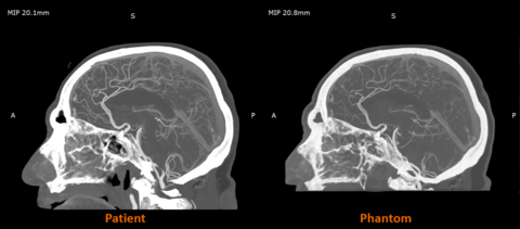 RadioMatrix: Stratasys expande acesso à impressão 3D radiopaca específica do paciente para imagens médicas