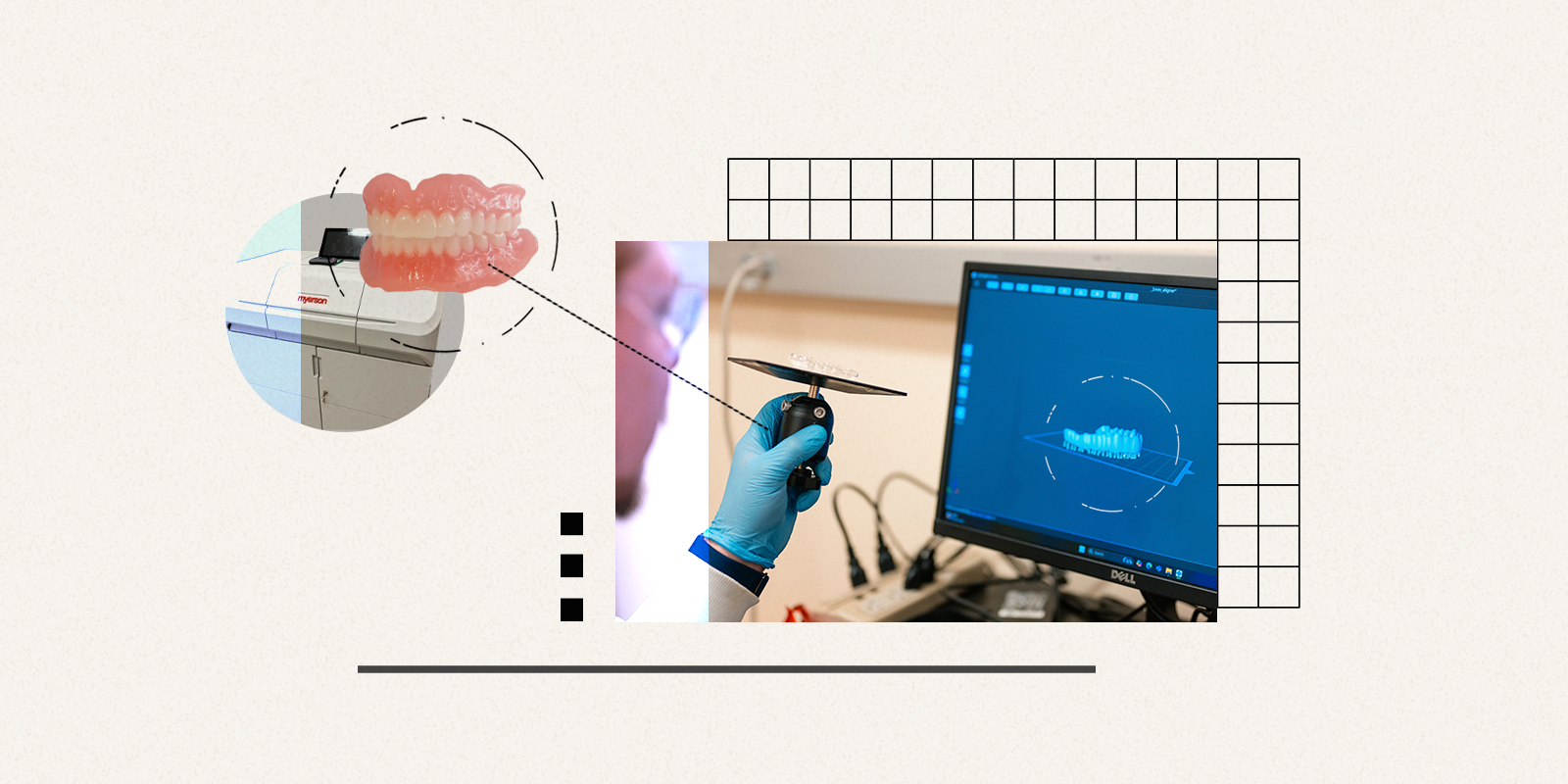 CU Anschutz Researchers Reinvent the Denture: Faster, Smarter, and Built to Fight Bacteria