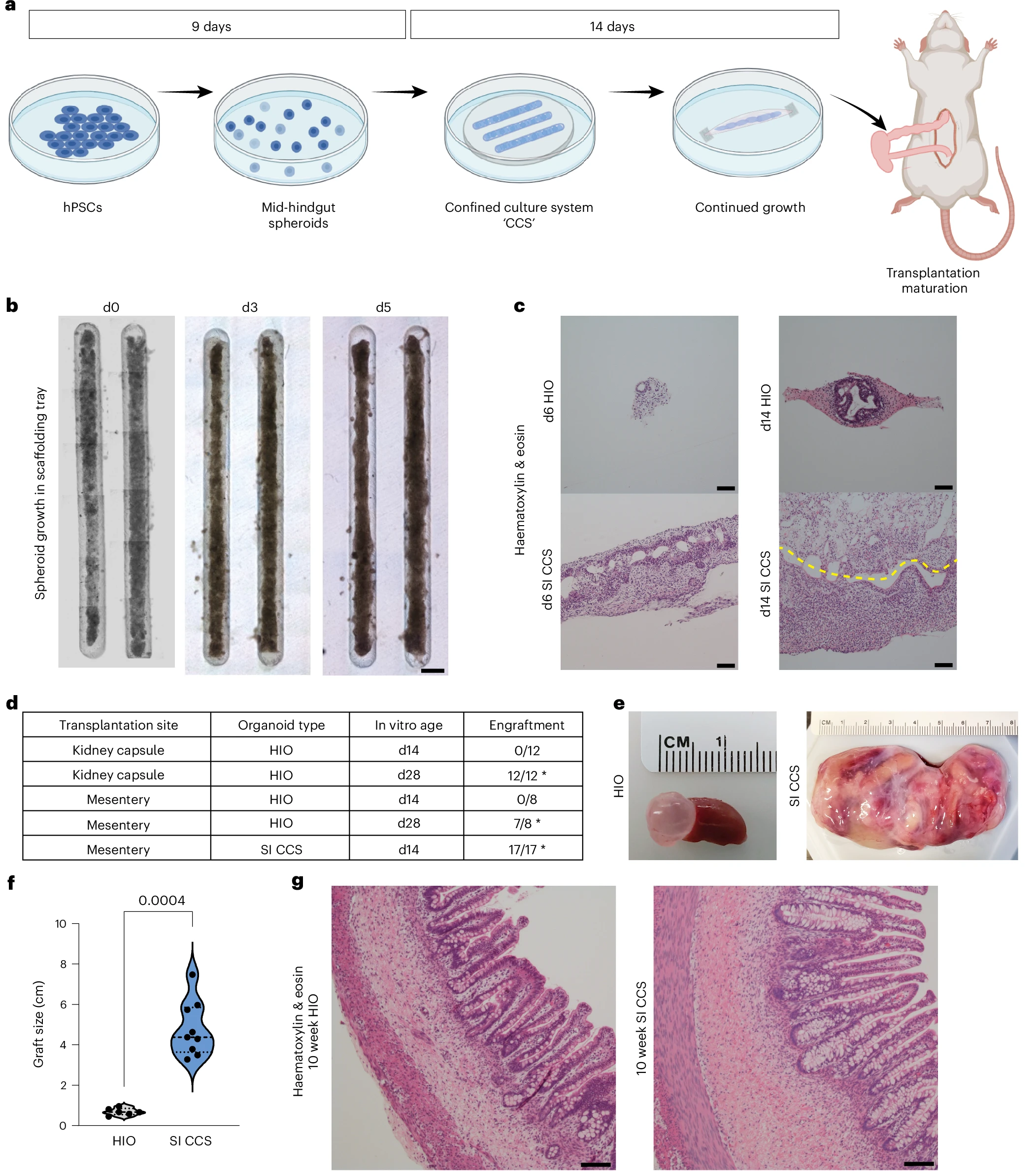 Scientists Grow Functional Human Gut Tissue With Its Own Nervous System