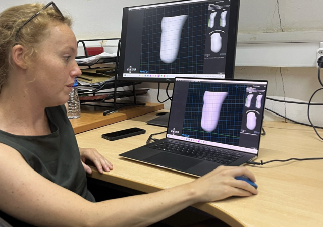 3D scanning and printing of prosthetic sockets. Photo via STAND.