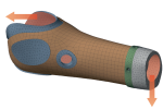 Italian researchers use field-driven lattice design to cut prosthetic socket weight by 25%