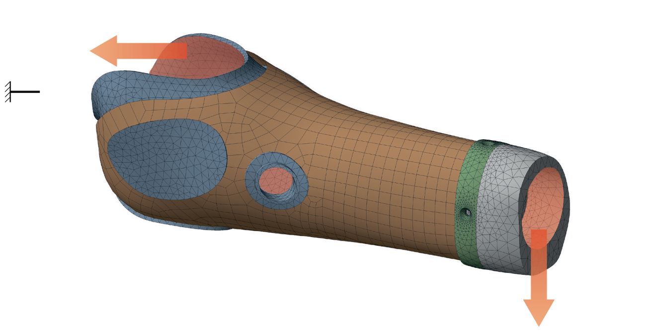 Italian researchers use field-driven lattice design to cut prosthetic socket weight by 25%