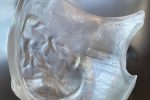 Myrava Moves Into Radiation Therapy With Cleared 3D Printed Bolus